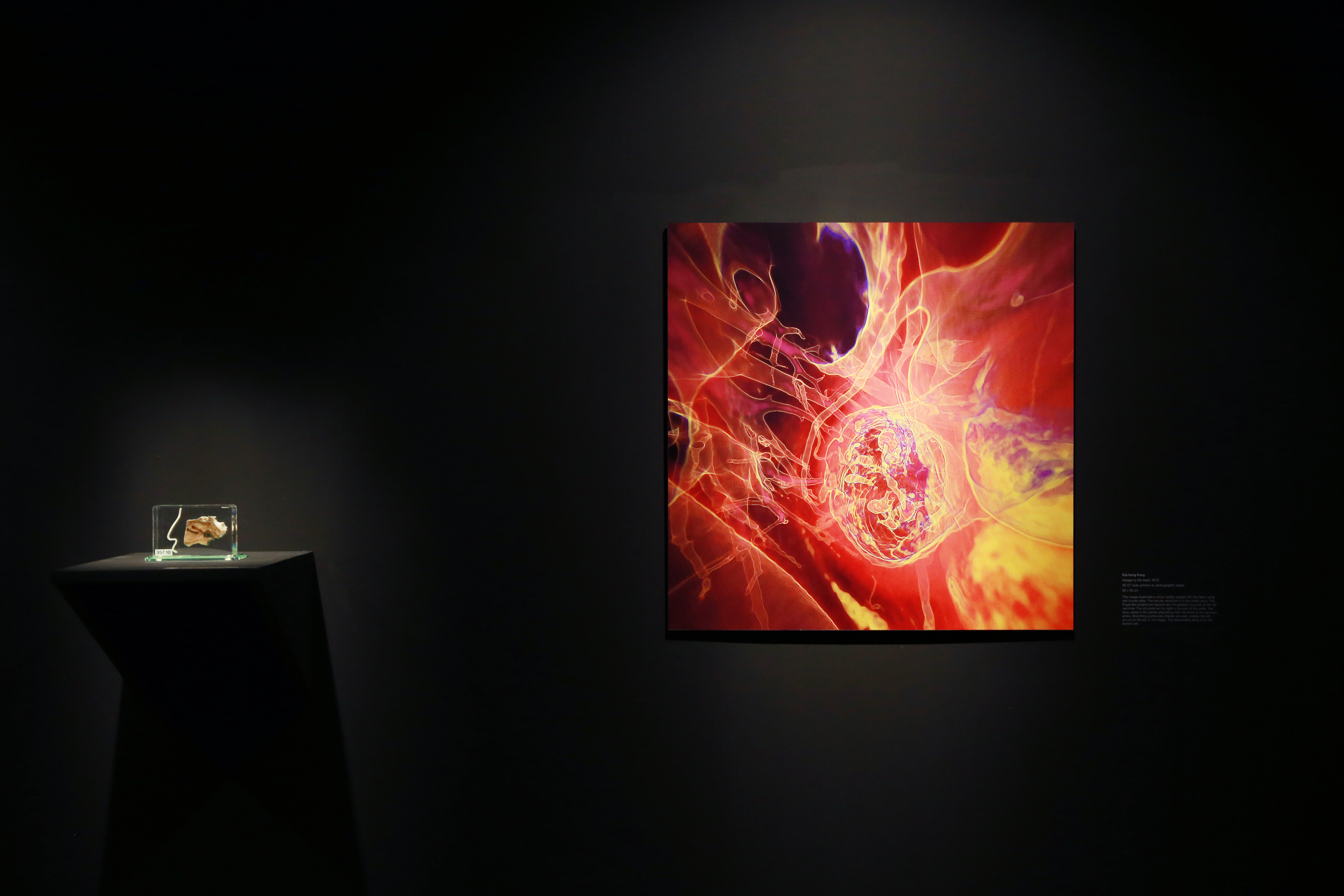 Installation view, 'Body Image', UNSW Galleries, 2014. Pictured: Collection, Museum of Human Disease; and, Kai-Hung Fung, Voyage to the heart 2012. Photograph: Britta Campion