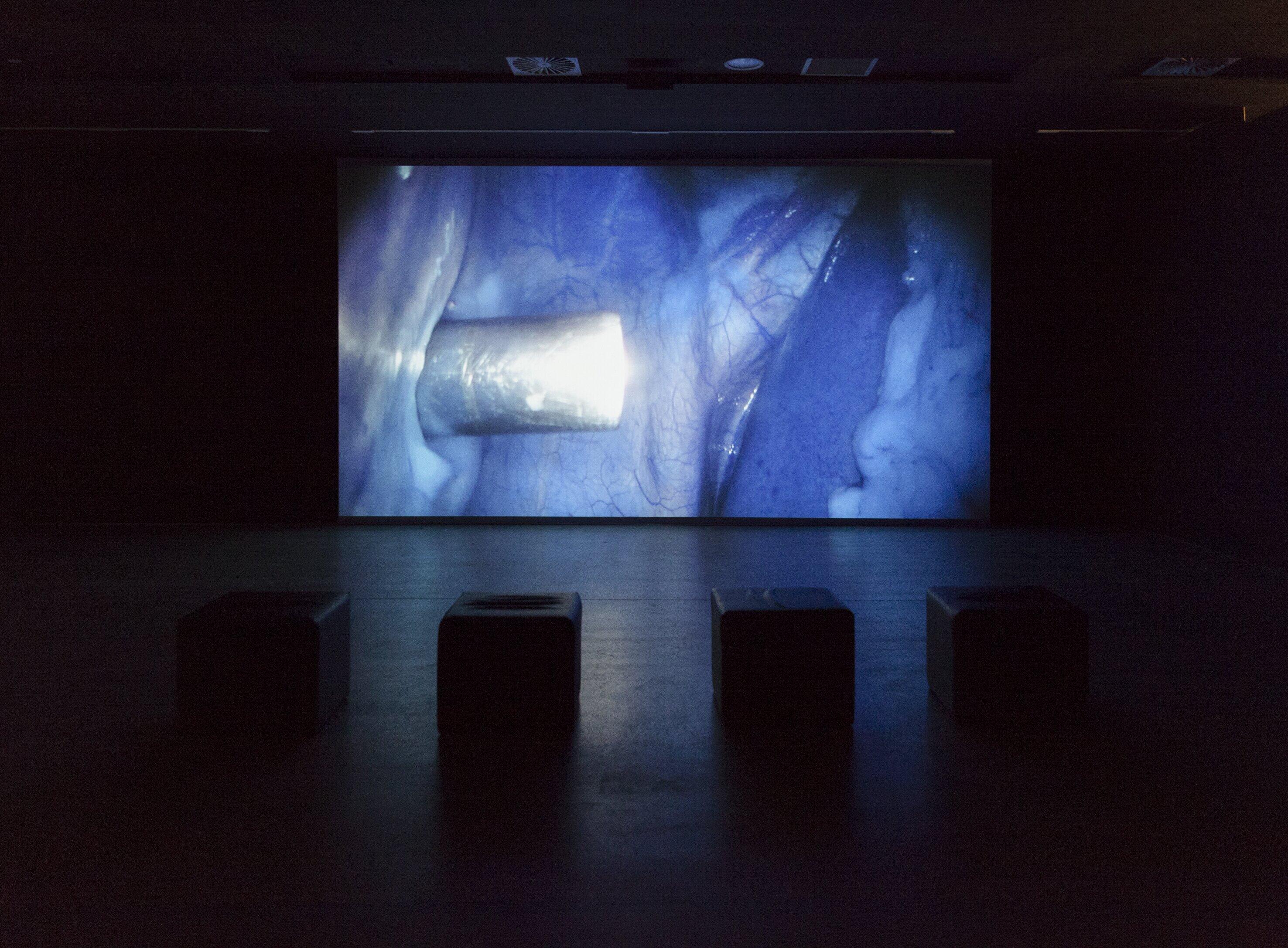 Installation view